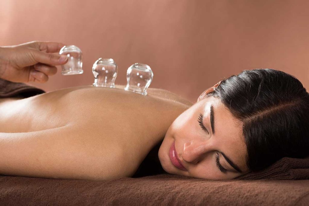 Cupping therapy